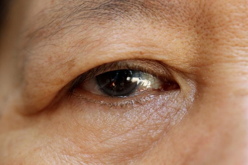 older people wrinkly eyes